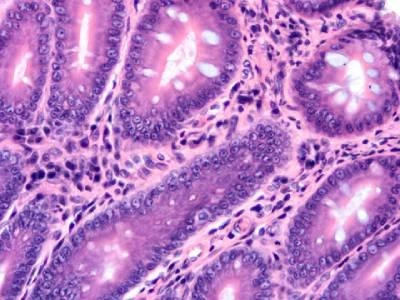 Histopathology Samples